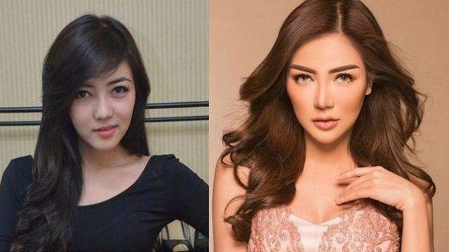 Beda Banget dan Manglingin! Foto Artis Sebelum dan Sesudah Oplas