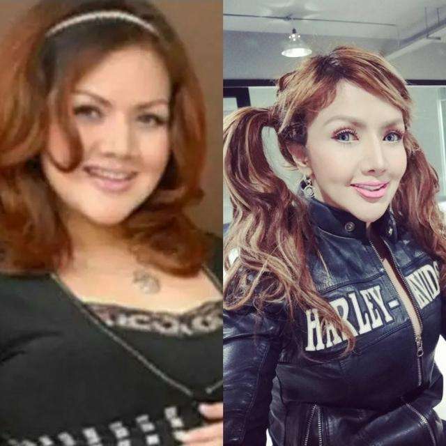 Beda Banget dan Manglingin! Foto Artis Sebelum dan Sesudah Oplas