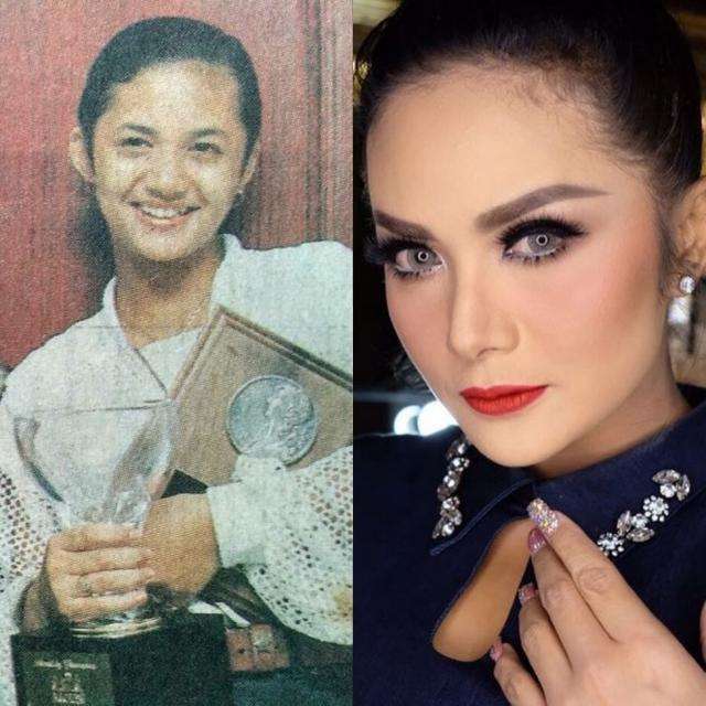 Beda Banget dan Manglingin! Foto Artis Sebelum dan Sesudah Oplas