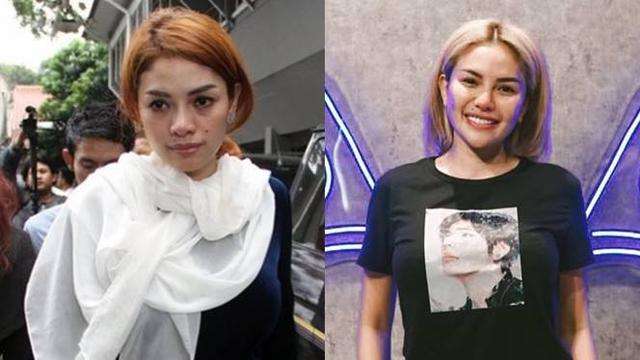 Beda Banget dan Manglingin! Foto Artis Sebelum dan Sesudah Oplas