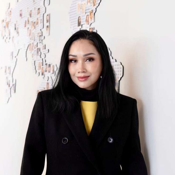 Wajah Titi DJ Berubah usai Jalani Operasi Plastik Anti Penuaan