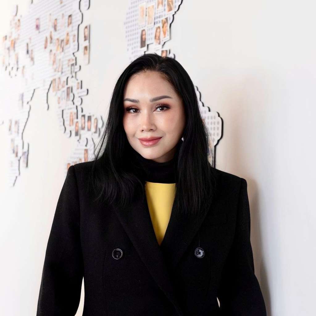 Wajah Titi DJ Berubah usai Jalani Operasi Plastik Anti Penuaan