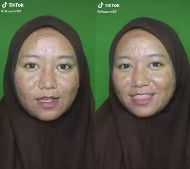 Wanita Penuh Jerawat Meradang & Bopeng Dirias MUA Jadi Pengantin, Hasilnya Bikin Kaget!