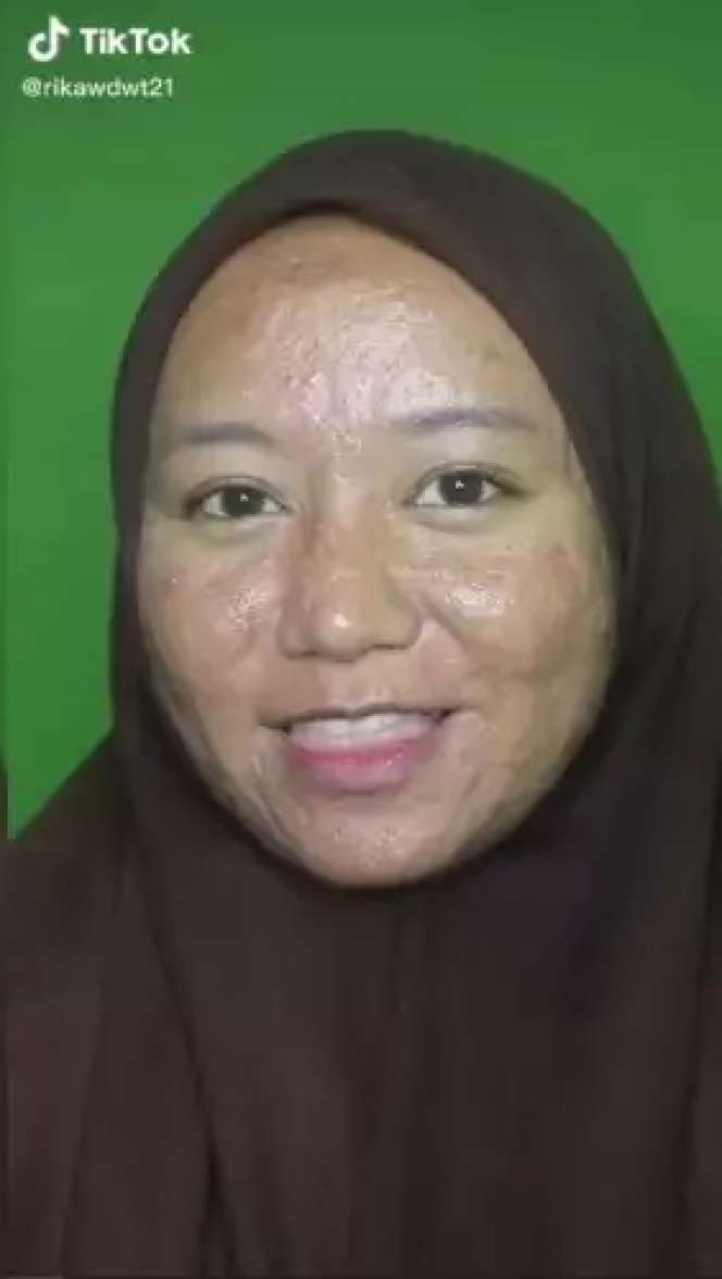 Wanita Penuh Jerawat Meradang & Bopeng Dirias MUA Jadi Pengantin, Hasilnya Bikin Kaget!