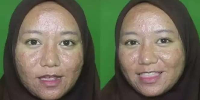 Wanita Penuh Jerawat Meradang & Bopeng Dirias MUA Jadi Pengantin, Hasilnya Bikin Kaget!