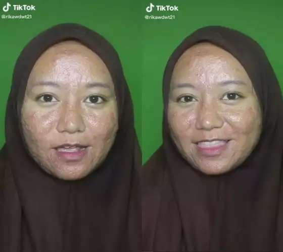 Wanita Penuh Jerawat Meradang & Bopeng Dirias MUA Jadi Pengantin, Hasilnya Bikin Kaget!