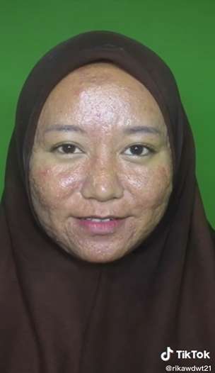 Wanita Penuh Jerawat Meradang & Bopeng Dirias MUA Jadi Pengantin, Hasilnya Bikin Kaget!