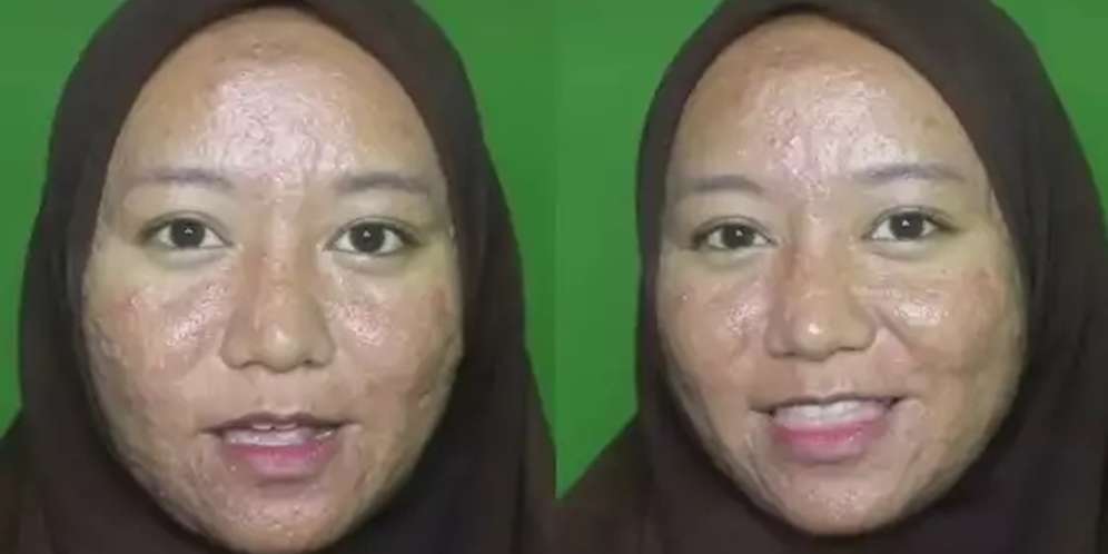 Wanita Penuh Jerawat Meradang & Bopeng Dirias MUA Jadi Pengantin, Hasilnya Bikin Kaget!