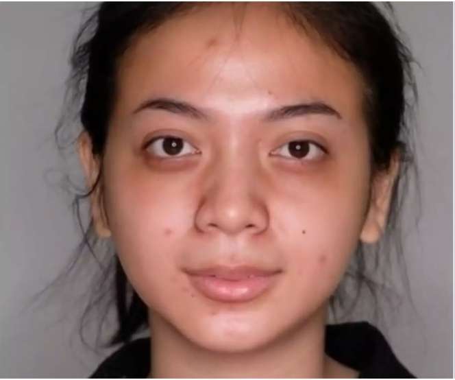 Wanita Dengan Bekas Jerawat Dimakeup MUA Ala Barbie, Hasilnya Bikin Lupa Wajah Aslinya