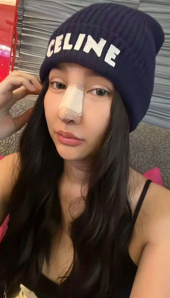 Disebut Mirip Hidung Pinocchio, Potret Terbaru Lucinta Luna Jalani Operasi Plastik Lagi di Thailand