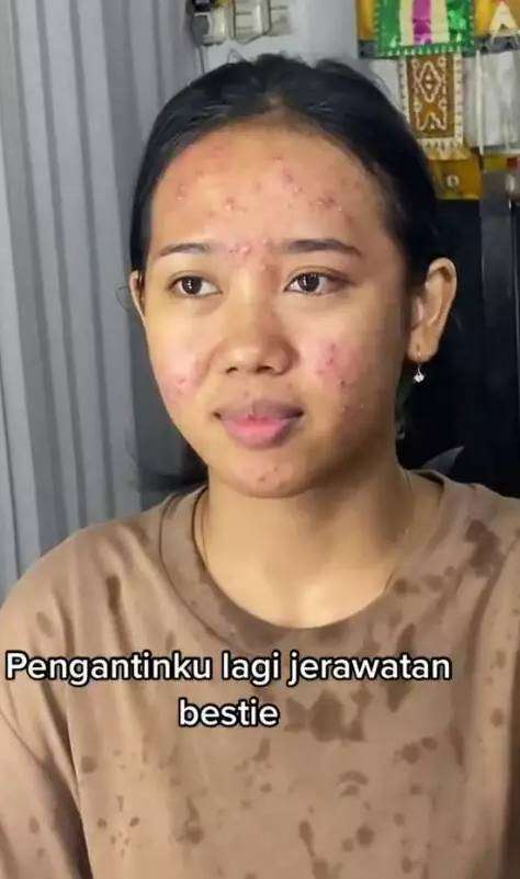 Potret Transformasi Pengantin Wanita Berjerawat Diubah MUA 'Skill Tingkat Dewa', Hasilnya Bikin Auto Melongo yang Lihat! 