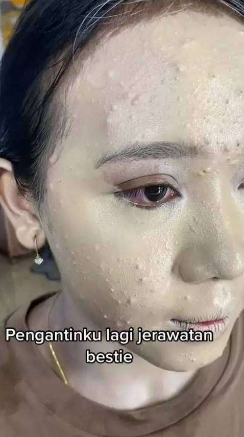 Potret Transformasi Pengantin Wanita Berjerawat Diubah MUA 'Skill Tingkat Dewa', Hasilnya Bikin Auto Melongo yang Lihat! 