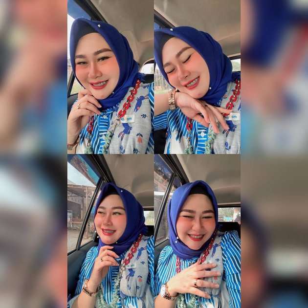 7 Potret Cantiknya Shelvie Hana, Istri Daus Mini yang Gugat Cerai Usai Diselingkuhi