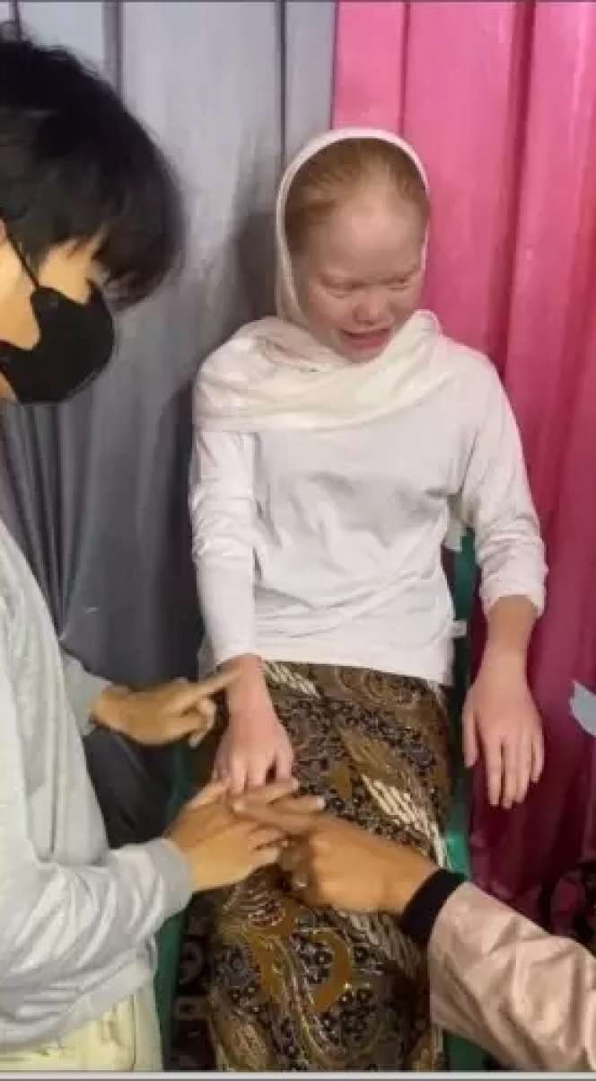 8 Transformasi Wanita dengan Kelainan Langka Albino Dirias MUA Jadi Pengantin Sunda, Hasilnya Super Unik!