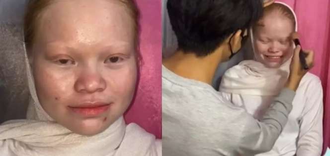 8 Transformasi Wanita dengan Kelainan Langka Albino Dirias MUA Jadi Pengantin Sunda, Hasilnya Super Unik!