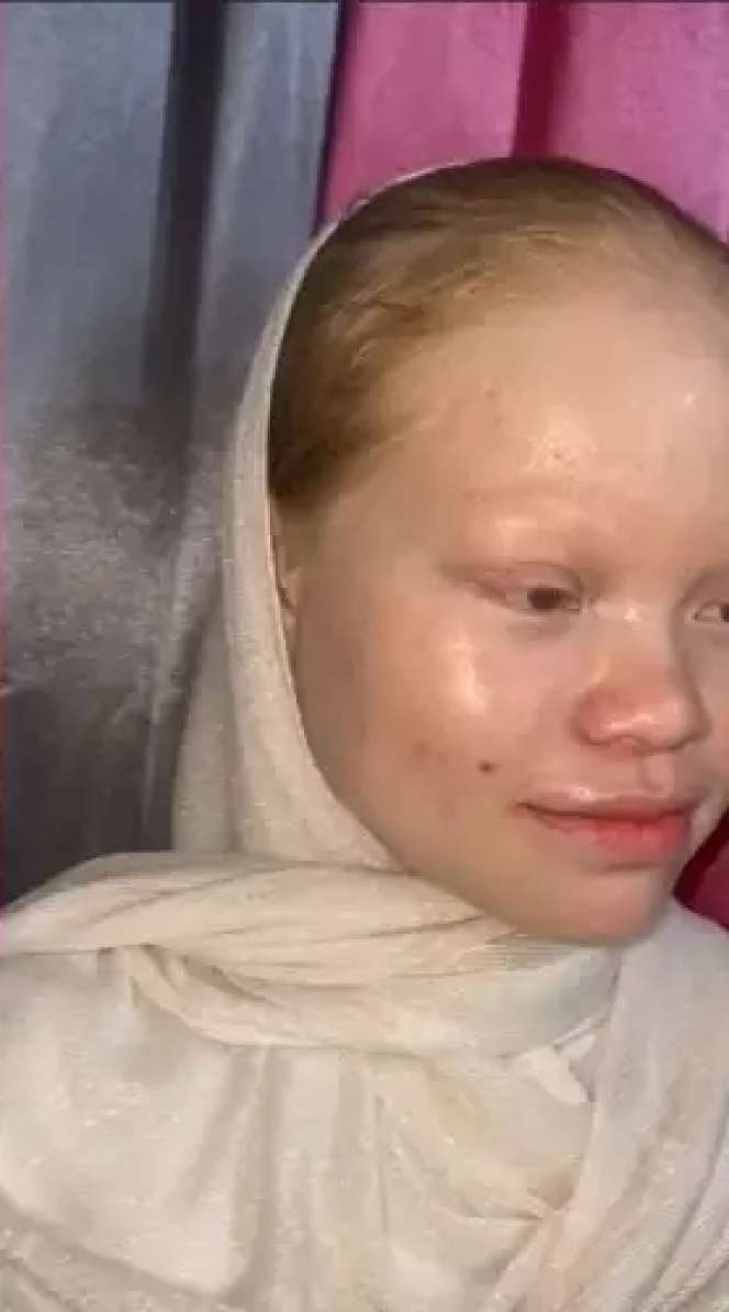 8 Transformasi Wanita dengan Kelainan Langka Albino Dirias MUA Jadi Pengantin Sunda, Hasilnya Super Unik!