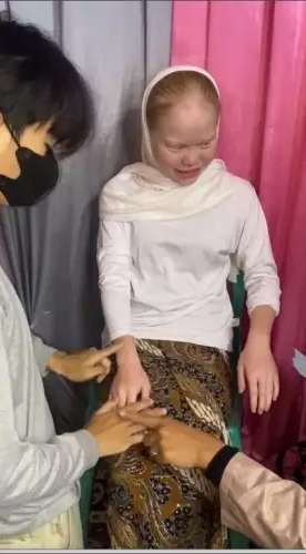8 Transformasi Wanita dengan Kelainan Langka Albino Dirias MUA Jadi Pengantin Sunda, Hasilnya Super Unik!