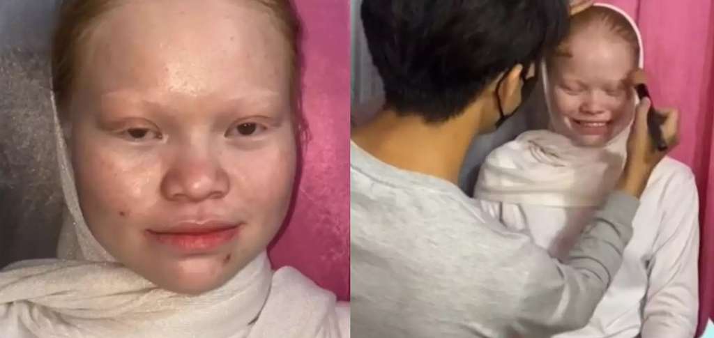 8 Transformasi Wanita dengan Kelainan Langka Albino Dirias MUA Jadi Pengantin Sunda, Hasilnya Super Unik!