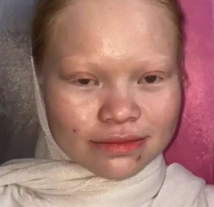 8 Transformasi Wanita dengan Kelainan Langka Albino Dirias MUA Jadi Pengantin Sunda, Hasilnya Super Unik!