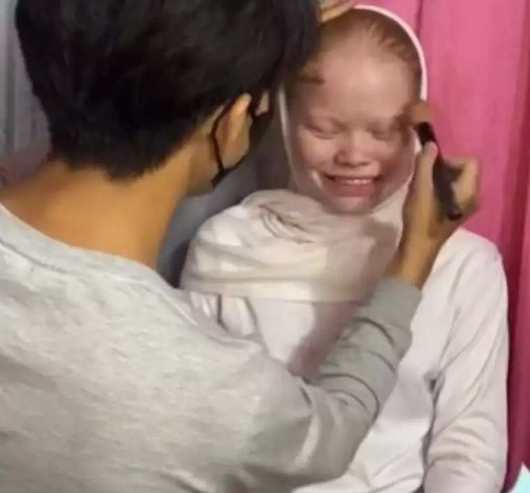 8 Transformasi Wanita dengan Kelainan Langka Albino Dirias MUA Jadi Pengantin Sunda, Hasilnya Super Unik!