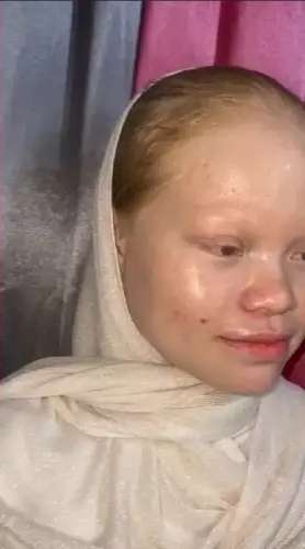 8 Transformasi Wanita dengan Kelainan Langka Albino Dirias MUA Jadi Pengantin Sunda, Hasilnya Super Unik!
