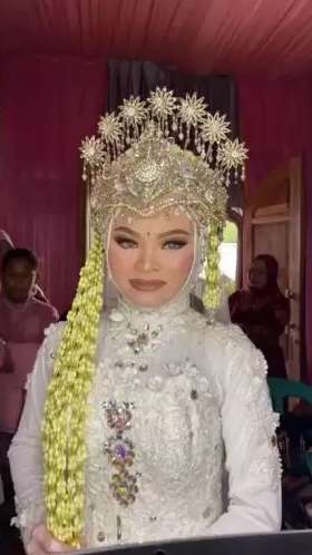 8 Transformasi Wanita dengan Kelainan Langka Albino Dirias MUA Jadi Pengantin Sunda, Hasilnya Super Unik!