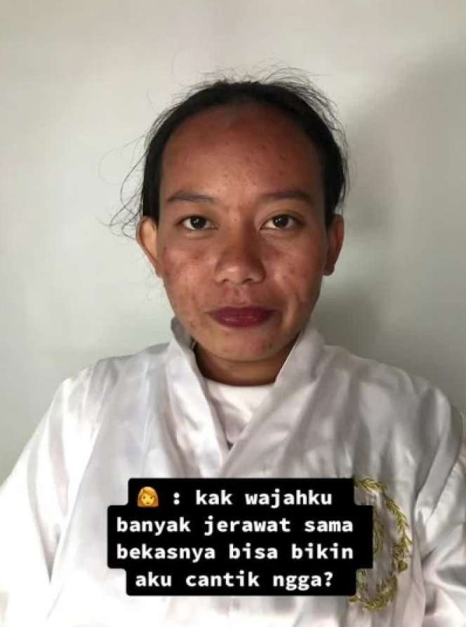 Pengantin dengan Bekas Jerawat Semuka Dirias MUA Ala Barbie, Lihat Hasilnya Bikin Syok!