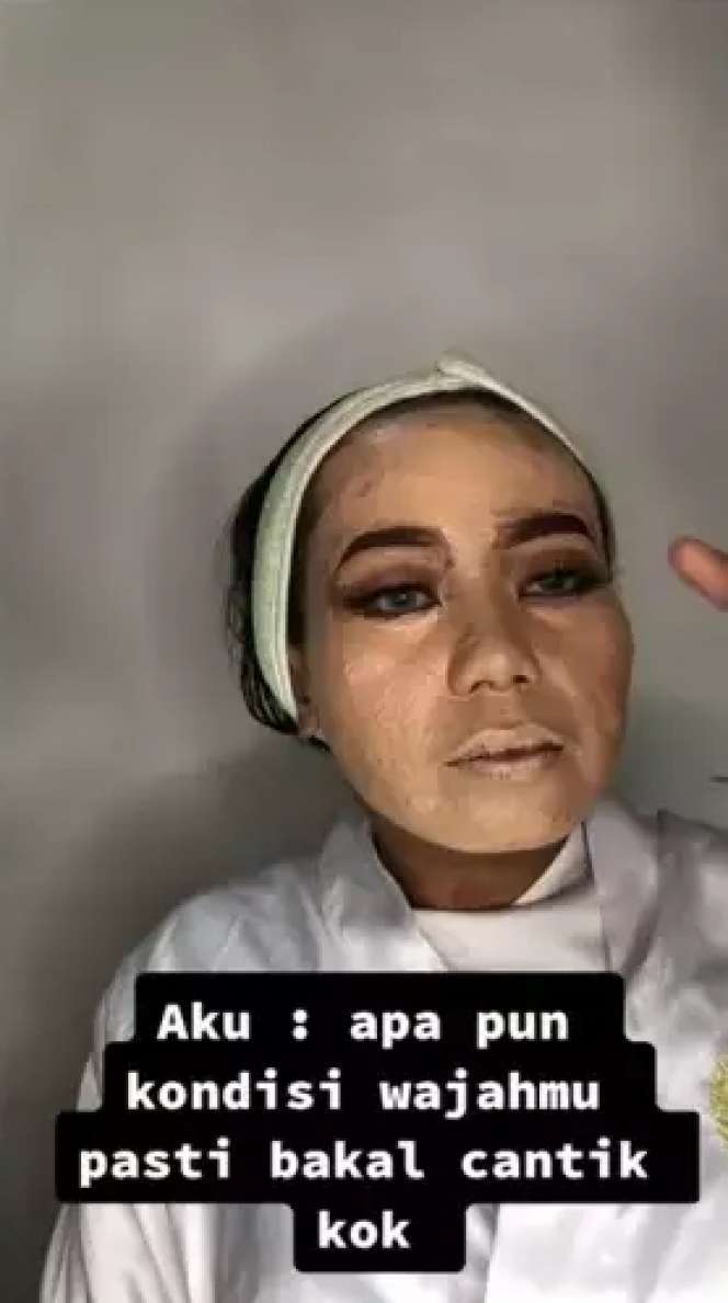 Pengantin dengan Bekas Jerawat Semuka Dirias MUA Ala Barbie, Lihat Hasilnya Bikin Syok!