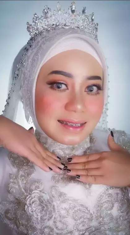 Pengantin dengan Bekas Jerawat Semuka Dirias MUA Ala Barbie, Lihat Hasilnya Bikin Syok!