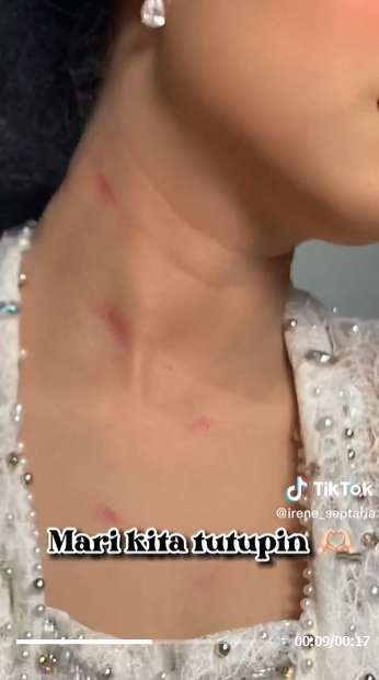 Viral MUA Bagikan Tips Tutupi Ruam Merah di Leher Pengantin, Netizen: Digigit Nyamuk Berkumis!