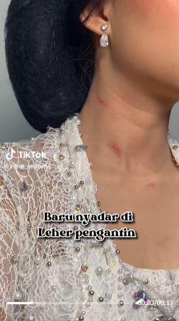 Viral MUA Bagikan Tips Tutupi Ruam Merah di Leher Pengantin, Netizen: Digigit Nyamuk Berkumis!