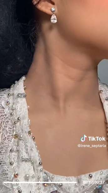 Viral MUA Bagikan Tips Tutupi Ruam Merah di Leher Pengantin, Netizen: Digigit Nyamuk Berkumis!