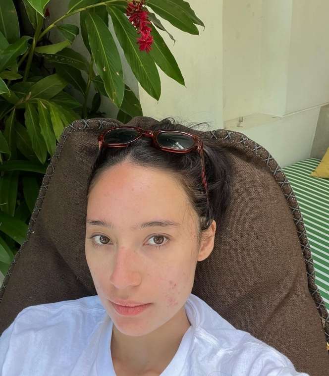 Potret Tatjana Saphira Pede Pamerkan Wajah Berjerawat