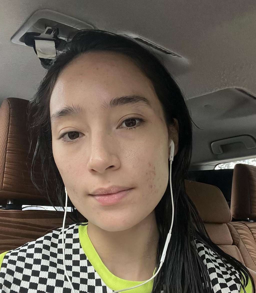 Potret Tatjana Saphira Pede Pamerkan Wajah Berjerawat