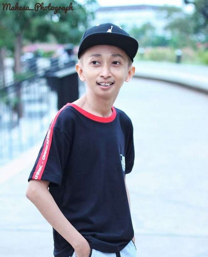 Ingat Omo Kucrut, Pemeran Si Ceking di Sinetron Ronaldowati? Kini Jadi DJ Terkenal, Penampilannya Saat Manggung Bikin Pangling