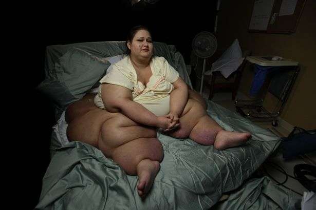 Masih Ingat Wanita Paling Gendut Berbobot 480 Kg? Dulu Akui Tindih Keponakan Hingga Meninggal, Kini Penampilannya Berubah Drastis!