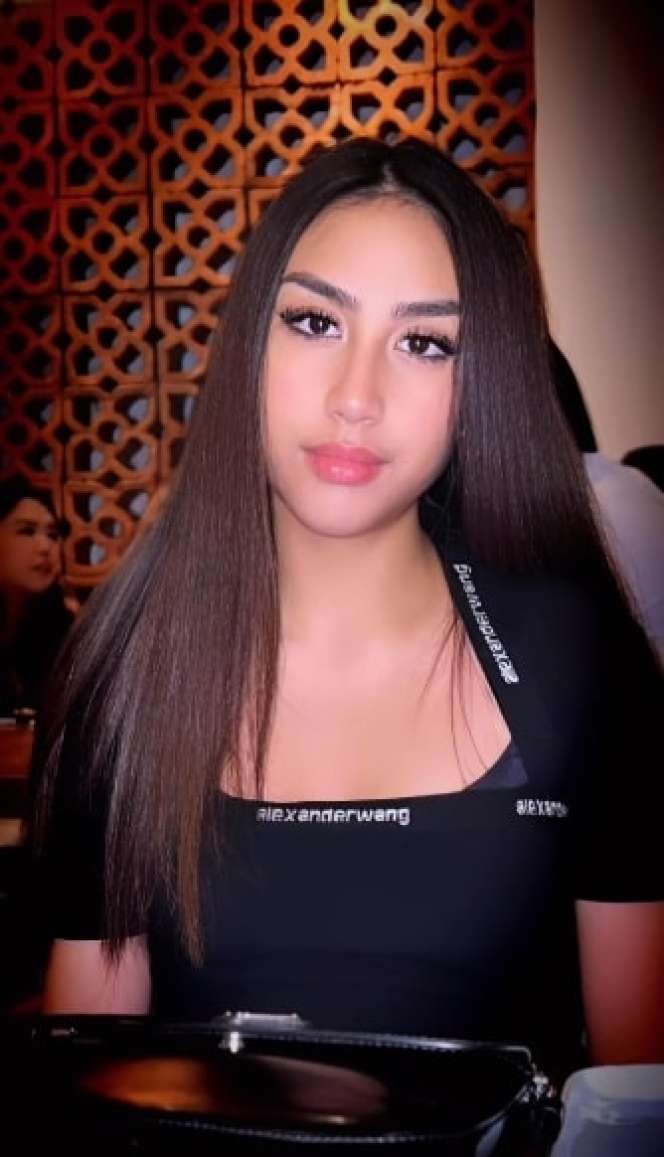 Masih Ingat Khayra Anak Gunawan Sudrajat yang Dulu Dibully Itik Buruk Rupa? Kini Penampilannya Bikin Pangling, Haters Auto Bungkam!
