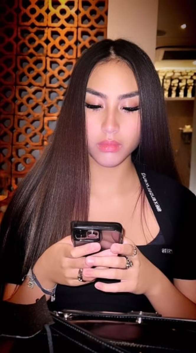 Masih Ingat Khayra Anak Gunawan Sudrajat yang Dulu Dibully Itik Buruk Rupa? Kini Penampilannya Bikin Pangling, Haters Auto Bungkam!