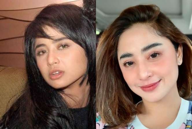 11 Potret Artis Disebut Oplas Karena Wajahnya Terlihat Beda, Adik Raffi Ahmad Berubah Banget!