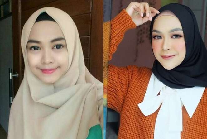 11 Potret Artis Disebut Oplas Karena Wajahnya Terlihat Beda, Adik Raffi Ahmad Berubah Banget!