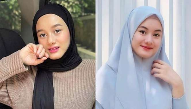 11 Potret Artis Disebut Oplas Karena Wajahnya Terlihat Beda, Adik Raffi Ahmad Berubah Banget!