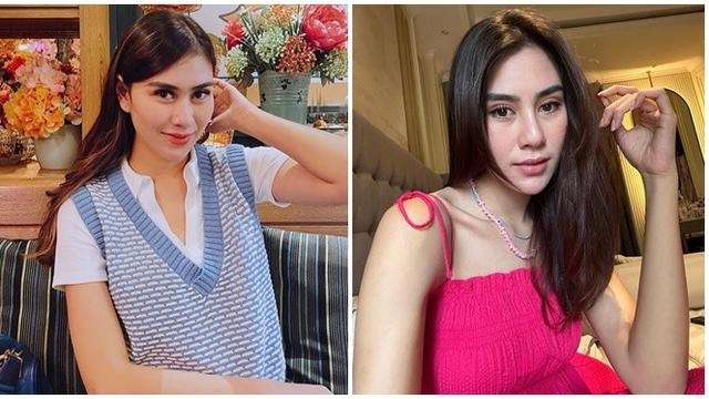 11 Potret Artis Disebut Oplas Karena Wajahnya Terlihat Beda, Adik Raffi Ahmad Berubah Banget!
