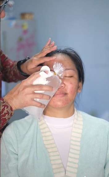 Potret Pengantin dengan Wajah Berjerawat Dirias MUA Adat Jawa, Hasilnya Bikin Pangling, Ternyata Ada Teknik Khusus!