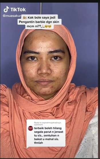 Pengantin Wajah Berjerawat Ini Minta Dirias Ala Barbie, Hasilnya Malah Kayak Gini…