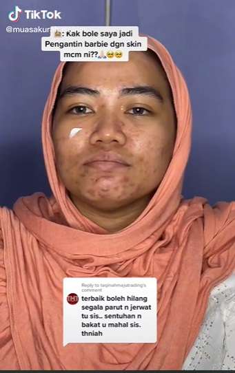 Pengantin Wajah Berjerawat Ini Minta Dirias Ala Barbie, Hasilnya Malah Kayak Gini…