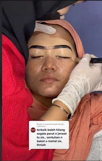 Pengantin Wajah Berjerawat Ini Minta Dirias Ala Barbie, Hasilnya Malah Kayak Gini…