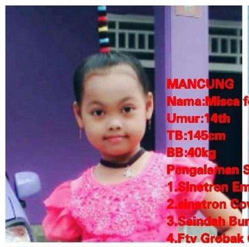 Masih Ingat Misca Fortuna si Mancung? Kini Sudah Remaja, Potret Penampilannya Bikin Kaget