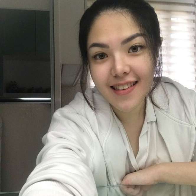 8 Potret Tina Toon Dulu VS Kini, Dari Tubuh Gempal Sekarang Bikin Pangling, Dicurigai Oplas!