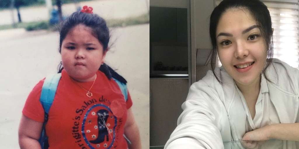8 Potret Tina Toon Dulu VS Kini, Dari Tubuh Gempal Sekarang Bikin Pangling, Dicurigai Oplas!