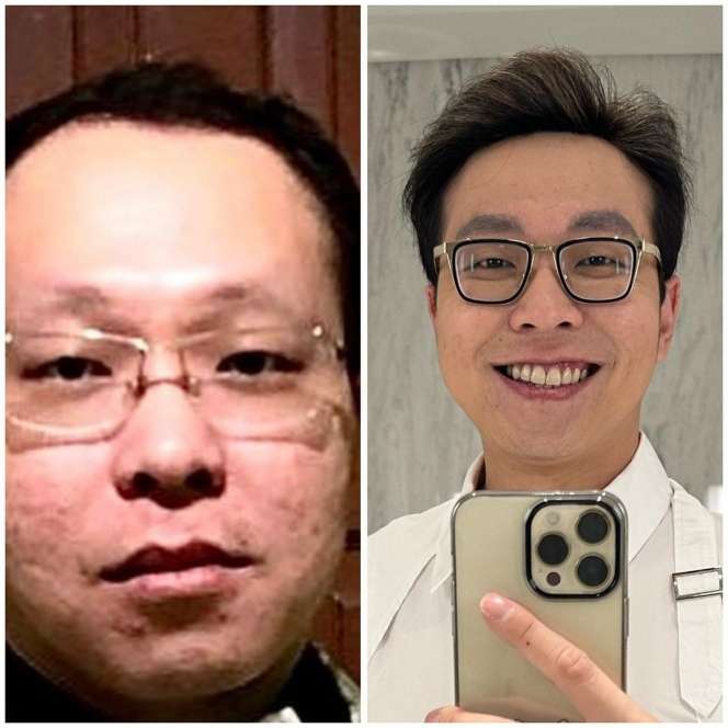 Viral! Foto-Foto `Aib` Dokter Richard Lee Sebelum Kenal Perawatan, Beda Banget, Bak Bumi Langit!
